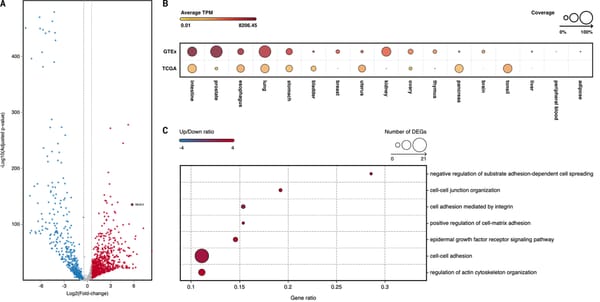 Gemcitabine efficacy across tumor types: A pan-cancer study of 50 cancer cell lines