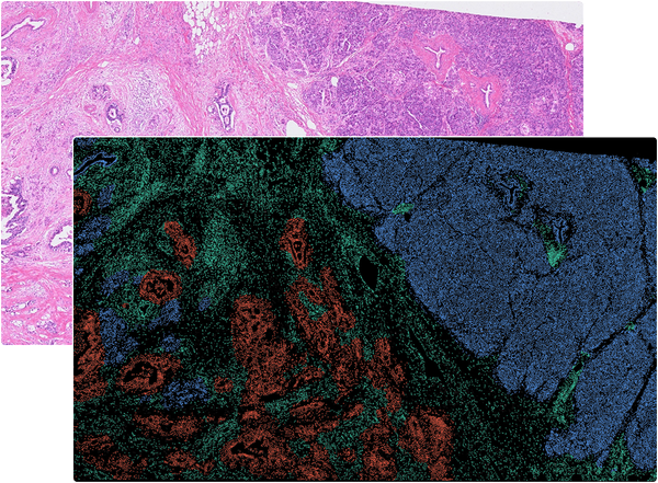 Tissue Segmentation in OmnibusX